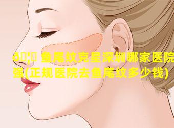 🦋 鱼尾纹克星深圳哪家医院强(正规医院去鱼尾纹多少钱)